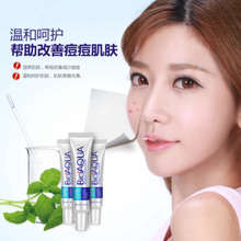 Load image into Gallery viewer, Acne Treatment, Blackhead Removal Cream, Anti Acne Cream Oil, Control Shrink Pores, Acne Scar Remover, Face Care Whitening
